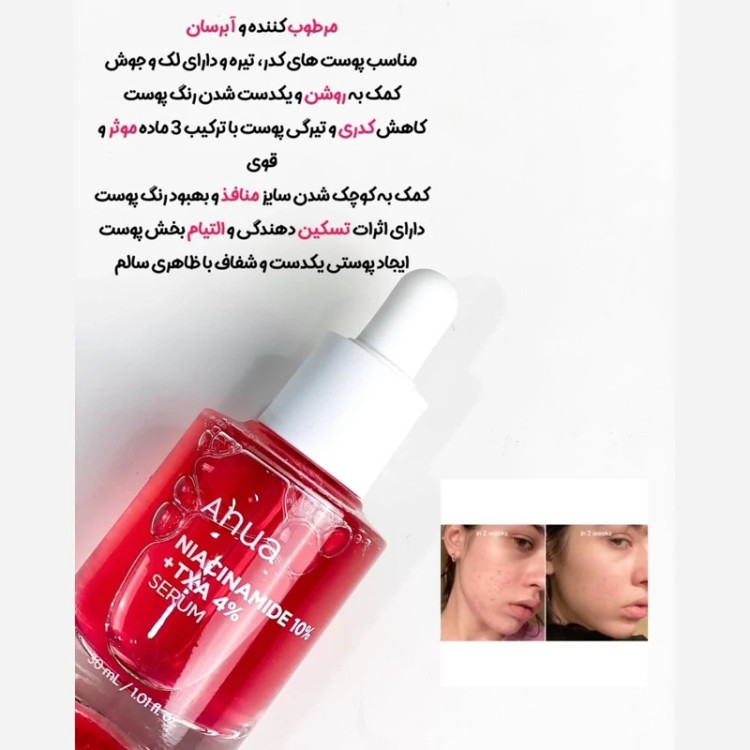 نیاسینامید آنوا (سرم 4کاره)