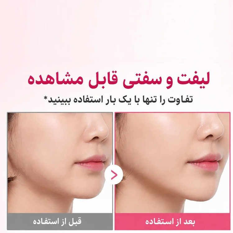 کرم گواشا مدیکیوب حاوی PDRN و کلاژن و 5% ولوفیلین – پر کننده خطوط چروک صورت و گردن و رفع افتادگی پوست / Medicube